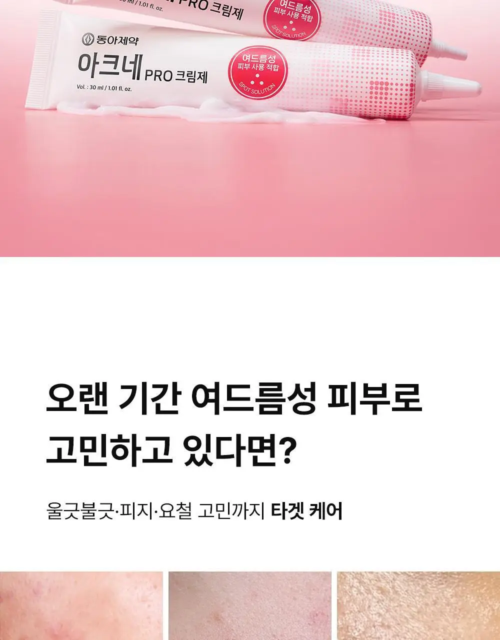 [트러블표적케어] 동아제약 아크네 프로 크림제 30ml 상세페이지 6